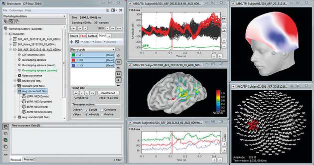 Der Brainstorm-Desktop mit grafischen Oberflächen für Organisation, Verarbeitung und Darstellung von MEG-/EEG-Daten