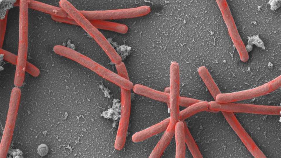 Kleine Mikrobe ganz groß: Der Organismus Methanothermobacter thermautotrophicus im Elektronenmikroskop 30.000-fach vergrößert.