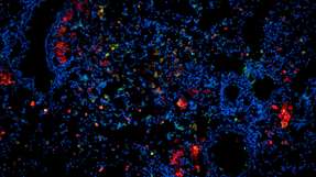 Die Mikroskopaufnahme eines Lungenschnittes einer mit TB infizierten Maus zeigt in Rot die Wirkstoff-Nanopartikel, in Blau die Kerne der Lungenzellen, und in Grün die Fresszellen oder Makrophagen, deren Aufgabe es eigentlich ist, Krankheitserreger zu beseitigen, die aber von den Tuberkulosebakterien als Wirtszelle ausgenutzt werden.