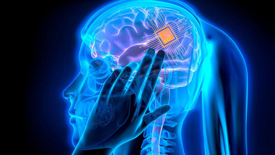 Das Start-up Neuralink hat erfolgreich einen drahtlosen Gehirn-Computerchip bei einem Menschen implantiert.