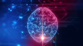 Das Gehirn wird digital: Eine Art Übersetzungs-Implantat ermöglicht es, Gehirn-Impulse in Befehle umzuwandeln, damit bewegungsunfähige Menschen technische Hilfsmittel bedienen und sich darüber besser verständigen können.