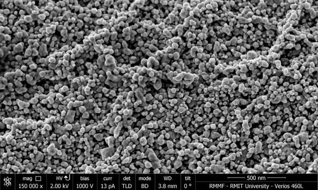 Bei 150.000-facher Vergrößerung sind die Nanopartikel deutlich zu erkennen.