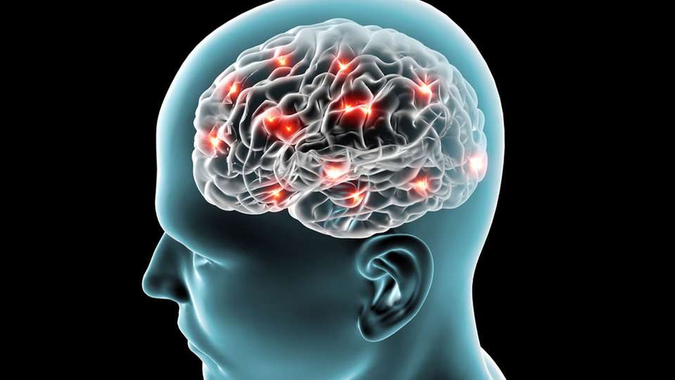 Intelligente Elektronik hilft bei der sicheren und schnellen Schlaganfalldiagnose.