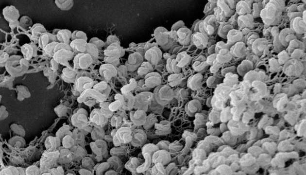 Elektronenmikroskopische Aufnahme eines Zell-Aggregats von Comammox-Bakterien der Art Nitrospira inopinata. Die spiralförmig gewundene Gestalt der Zellen ist gut erkennbar.