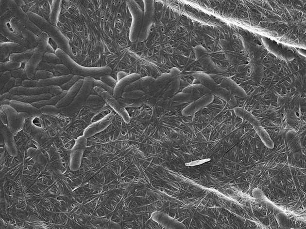 Stäbchenförmige Bakterien produzieren als fädige Struktur erkennbare Zellulose.