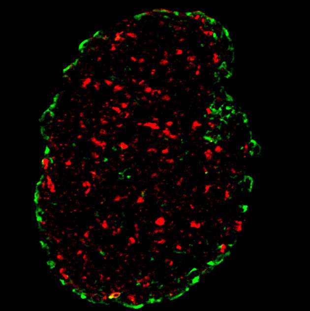 Während ihres Wachstums in 3D-Sphäroiden differenzieren sich Hautzellen. Menschliche HaCaT-Hautzellen wurden kultiviert, um 3D-Sphäroide zu bilden. Nach sieben Tagen wurden sie aufgeschnitten und Marker für Basalzellschichten (CK14, rot) und für weiter differenzierte Epidermisschichten (CK10, grün) eingefärbt. Die Abbildung zeigt einen konfokalen Ausschnitt zur Demonstration der Zellanordnungen in den Sphäroid-Kulturen (Bildgröße 376 µm). 