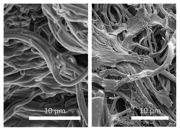 Spuren der Zeit auf der Mikrostrukturebene: Rasterelektronenmikroskopische Aufnahmen von Elastinfasern der Haut eines 6- (links) und 90-jährigen (rechts) Probanden.