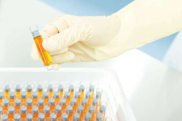 Mit den Multiuse-Anlagen können unterschiedliche Primärpackmittel befüllt werden – neben Karpulen auch Vials und Spritzen. 