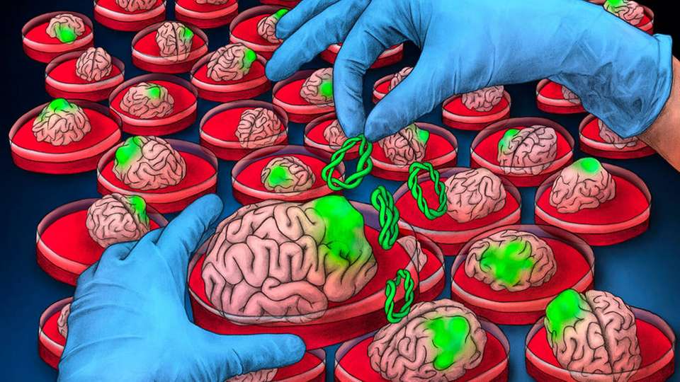 Künstlerische Interpretation neoplastischer Organoide, an denen sich untersuchen lässt, wie bestimmte Mutationen die Tumorentstehung beeinflussen.