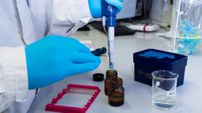 Der Schnelltest per Biochip soll auch kleine Coronavirus-Konzentrationen feststellen und somit fälschlich negative Tests ausschließen.