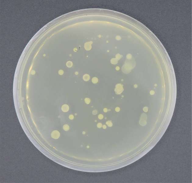 Die Bakterienkultur wird in einem Nährmedium ausplattiert.