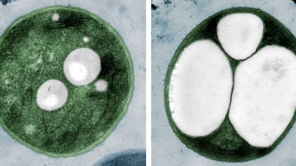 Mithilfe einiger Modifikationen haben Forscher aus Cyanobakterien „Plastikbakterien“ gemacht.