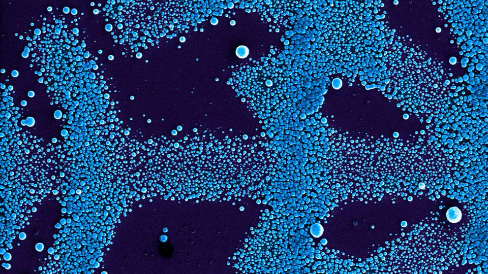 Um das Potenzial von Polydopamin nutzen zu können, braucht es solche Mikrostrukturen von wenigen Zehntausendstel Millimetern.