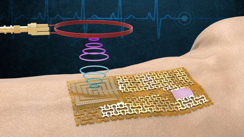 Das Gerät empfängt und überträgt Signale drahtlos ohne sperrige Chips oder Batterien.