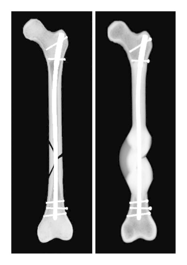 Computersimulation des Heilungsverlaufs eines Beispielpatienten