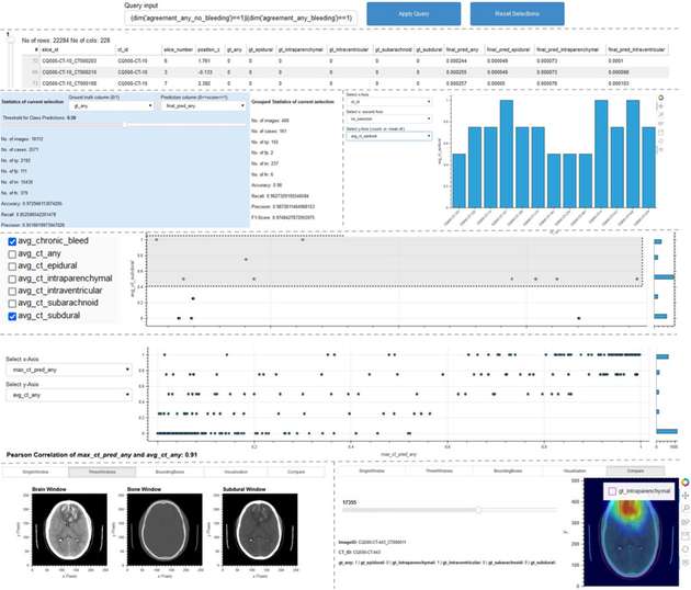 Das Tool ScrutinAI ermöglicht es, Fehler in KI-Modellen oder Trainingsdaten aufzudecken und die Ursachen dafür zu analysieren.