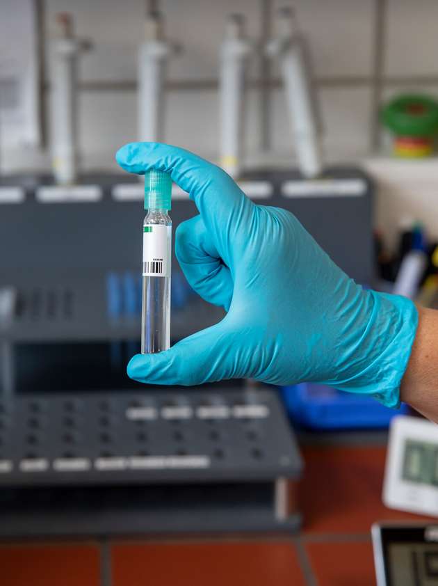 Im Labor werden täglich Abwasserproben aus allen Verfahrensschritten auf die wichtigsten Parameter wie CSB, Stickstoff, Phosphor und abfiltriebare Stoffe hin untersucht und analysiert.