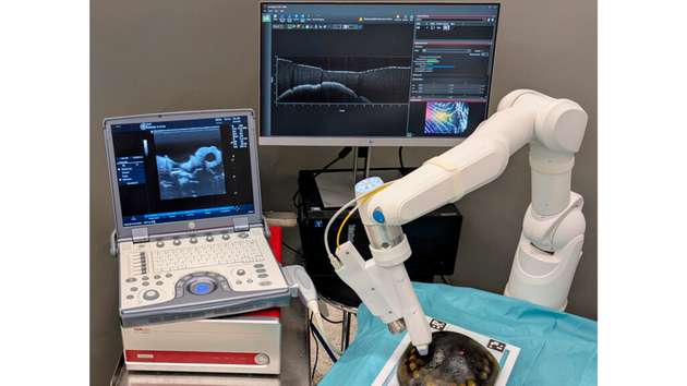Der DLR MIRO ist ein vielseitig einsetzbarer Roboterarm für medizinische Anwendungen. Er kann aus der Ferne gesteuert werden oder den Chirurgen direkt am OP-Tisch assistieren. Das Bild zeigt das neue Setup zur automatischen und präzisen Untersuchung von Gewebe.