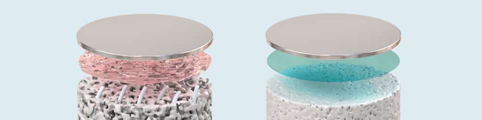 Links: Poröser Festelektrolyt, durch den Lithium-Dendriten (grau) bis zur Lithiumoberfläche (silbern) vordringen können; die Grenzfläche ist nur durch eine natürliche Grenzschicht (rosa) geschützt. Rechts: Am Paul-Scherrer-Institut hergestellter, dicht gesinterter Festelektrolyt mit stabilisierender Lithiumfluorid-Beschichtung (blau), die das Eindringen von Dendriten verhindert und die Lithiumoberfläche schützt.