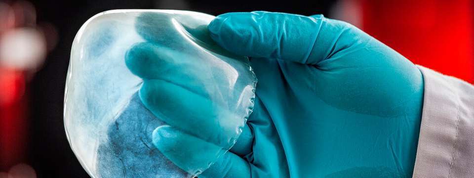 Der neu entwickelte biomimetische Gewebeersatz eröffnet neue Ansätze für leistungsfähige Implantate – hier demonstriert an einem gedruckten Herzbeutel (Perikard).