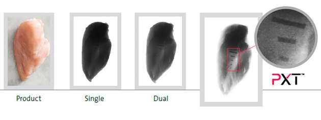 Fettanalyse und Knochenerkennung mit dem MAXIMIZER.