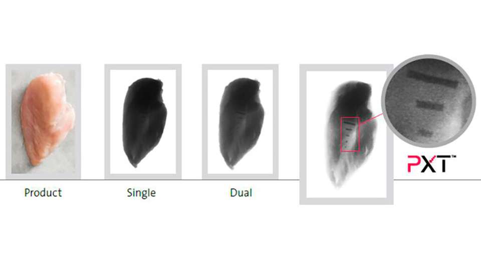 Fettanalyse und Knochenerkennung mit dem MAXIMIZER.