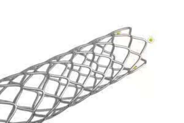 Stent mit Röntgenmarkern – befüllt mit minimalen Klebstoffmengen.
