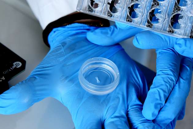 Die dreidimensionalen „Minimuskeln“ sind nur etwa 5 mm lang.