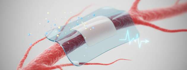 Eine neue Studie der Universität Chicago zeigt, wie ein Bestandteil von Lithium-Batterien die Grundlage für Therapien zur Schmerzlinderung oder zur Behandlung anderer Erkrankungen bilden könnte. Oben ist ein winziges, flexibles Pflaster zu sehen, das mit Nervengewebe verbunden werden kann, um die Schmerzsignale zu unterdrücken.