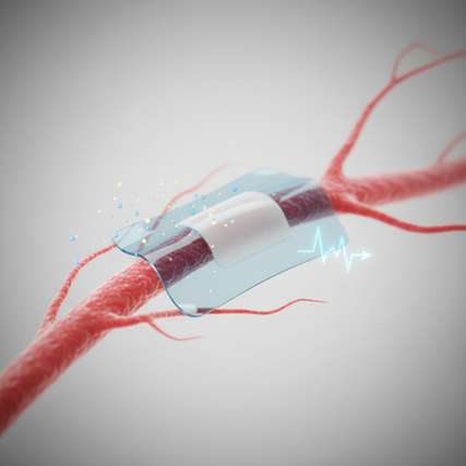 Eine neue Studie der Universität Chicago zeigt, wie ein Bestandteil von Lithium-Batterien die Grundlage für Therapien zur Schmerzlinderung oder zur Behandlung anderer Erkrankungen bilden könnte. Oben ist ein winziges, flexibles Pflaster zu sehen, das mit Nervengewebe verbunden werden kann, um die Schmerzsignale zu unterdrücken.